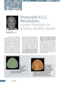 nuove frontiere in protesi mobile totale - Nobil