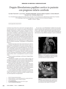 11.Tramontin (136-137) - Giornale Italiano di Cardiologia