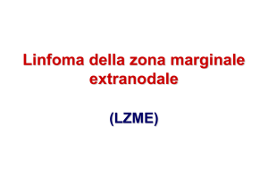 Linfoma della zona marginale extranodale (LZM)