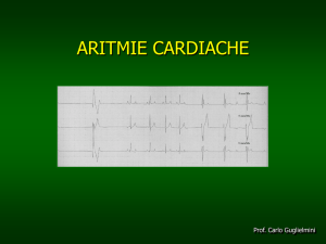 aritmia cardiaca - e