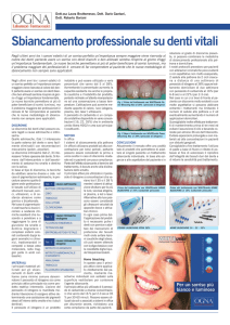 Sbiancamento professionale su denti vitali