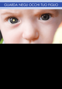 Il retinoblastoma è il tumore maligno oculare più frequente in