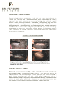 Informazione – Sutura Tricofitica Esempi di suture non